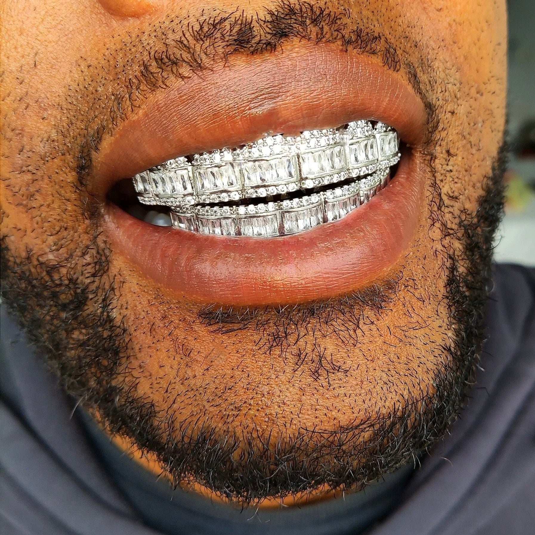 Baguette Diamond Grillz
