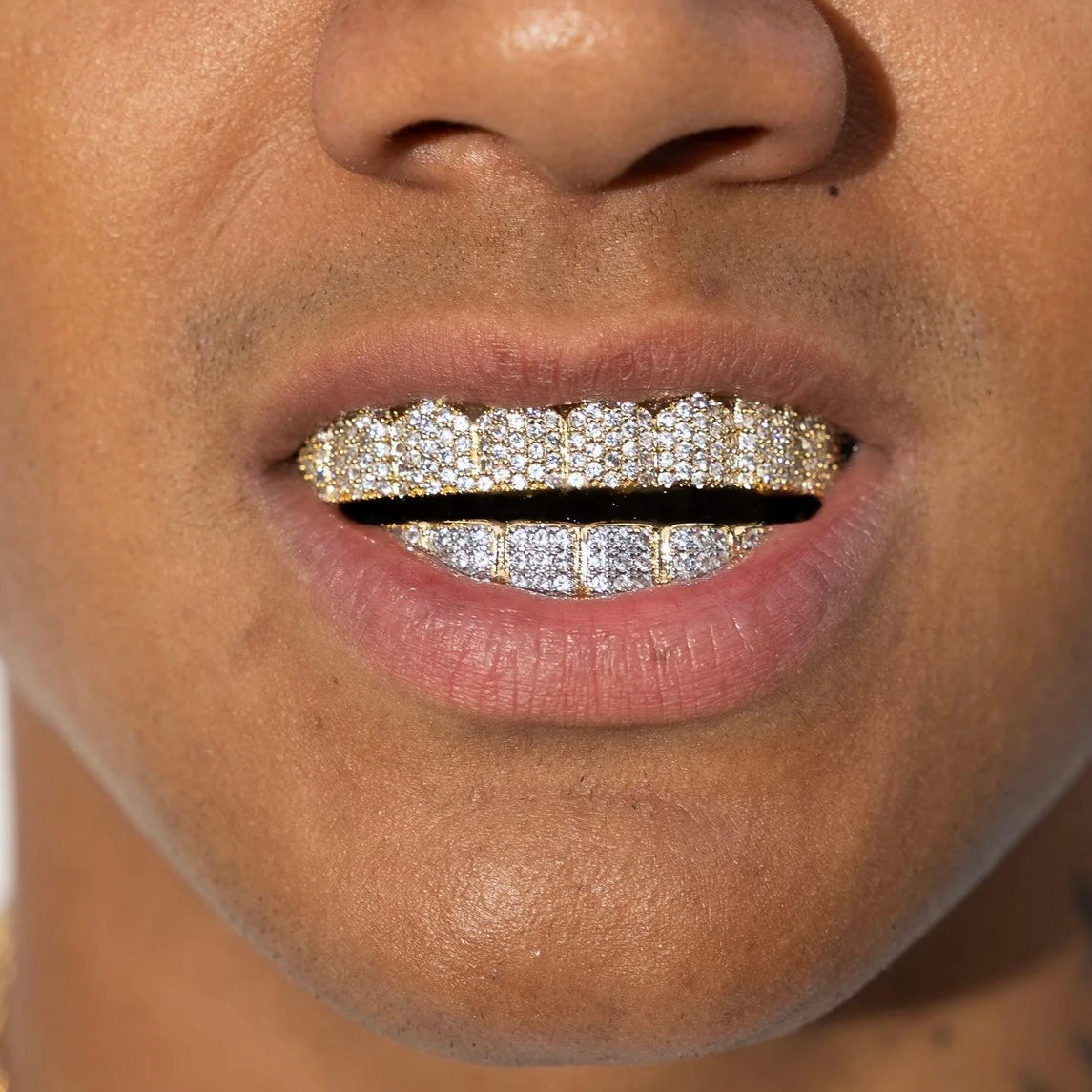 Gold Diamond Grillz